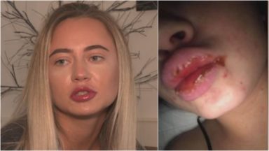 Beauticians providing lip injections ‘should be licensed’