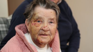 Care home resident found lying face down near road