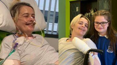 Mum’s Covid-19 battle while undergoing amputation surgery