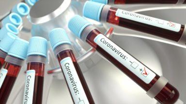 Coronavirus: Scotland records 758 new cases overnight