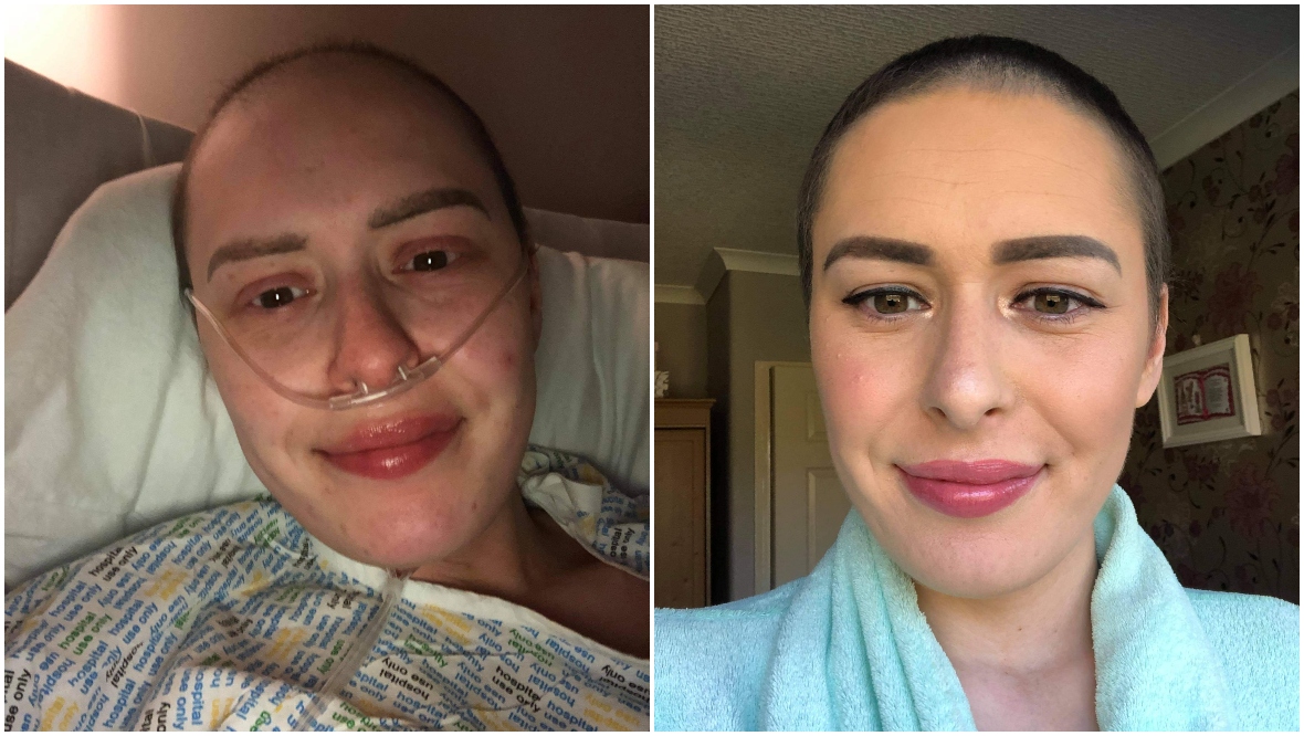 Nicole's dad told her 'bald is beautiful' when her hair fell out following treatment.