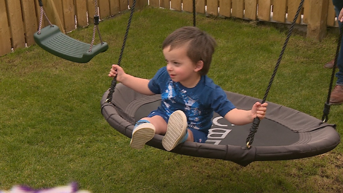 Home: Benjamin Arnott has a rare genetic condition.