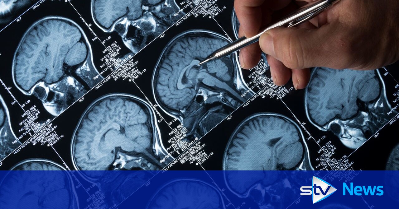 Hospital MRI and CT scans cancelled due to lack of staff background checks