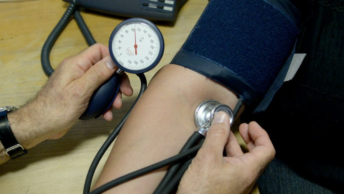 GPs warn long Covid cases putting them under ‘growing pressure’