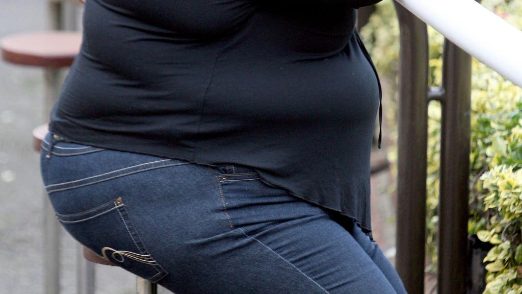 Surgery to tackle obesity should be performed earlier, study finds