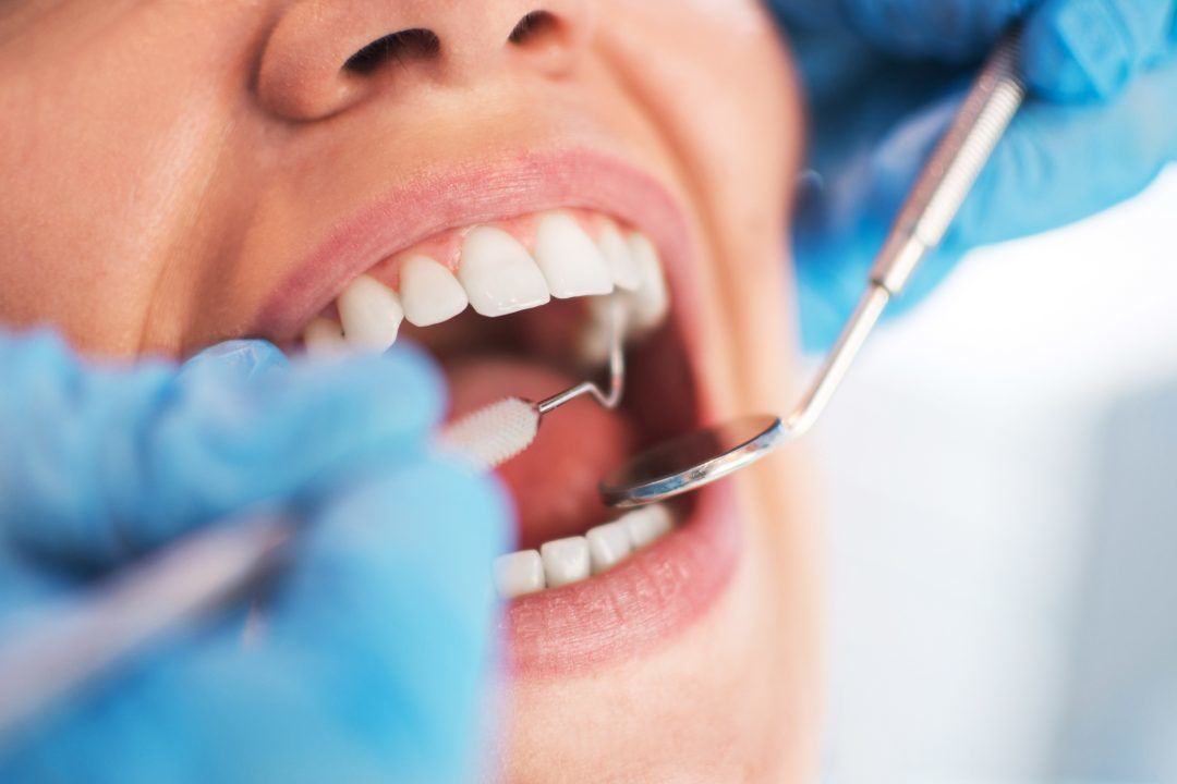 Dentist warning over undetected oral cancer during treatment backlog