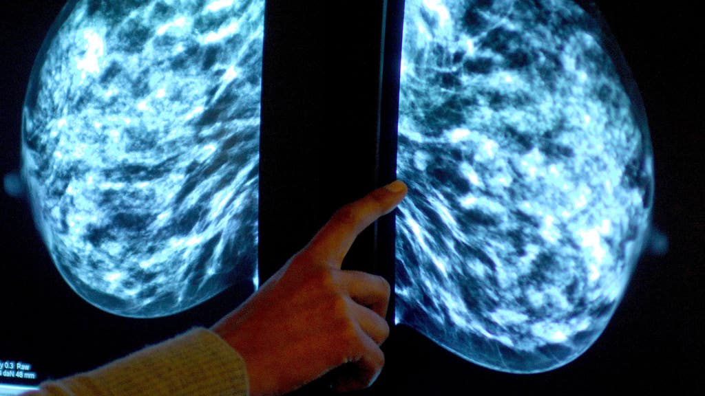 Longer waiting times could see cancer survival rate drop, says charity