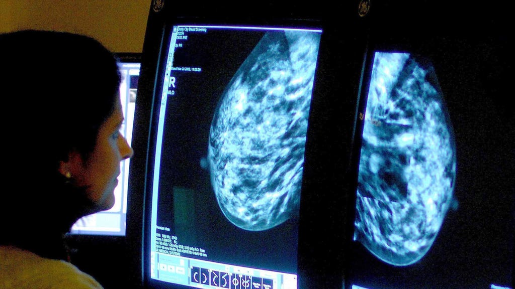 Early-stage cancer diagnosis misses Sturgeon’s target by more than 20%