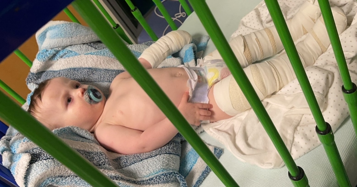 Nursery ignores calls to apologise and seeks appeal after baby burned