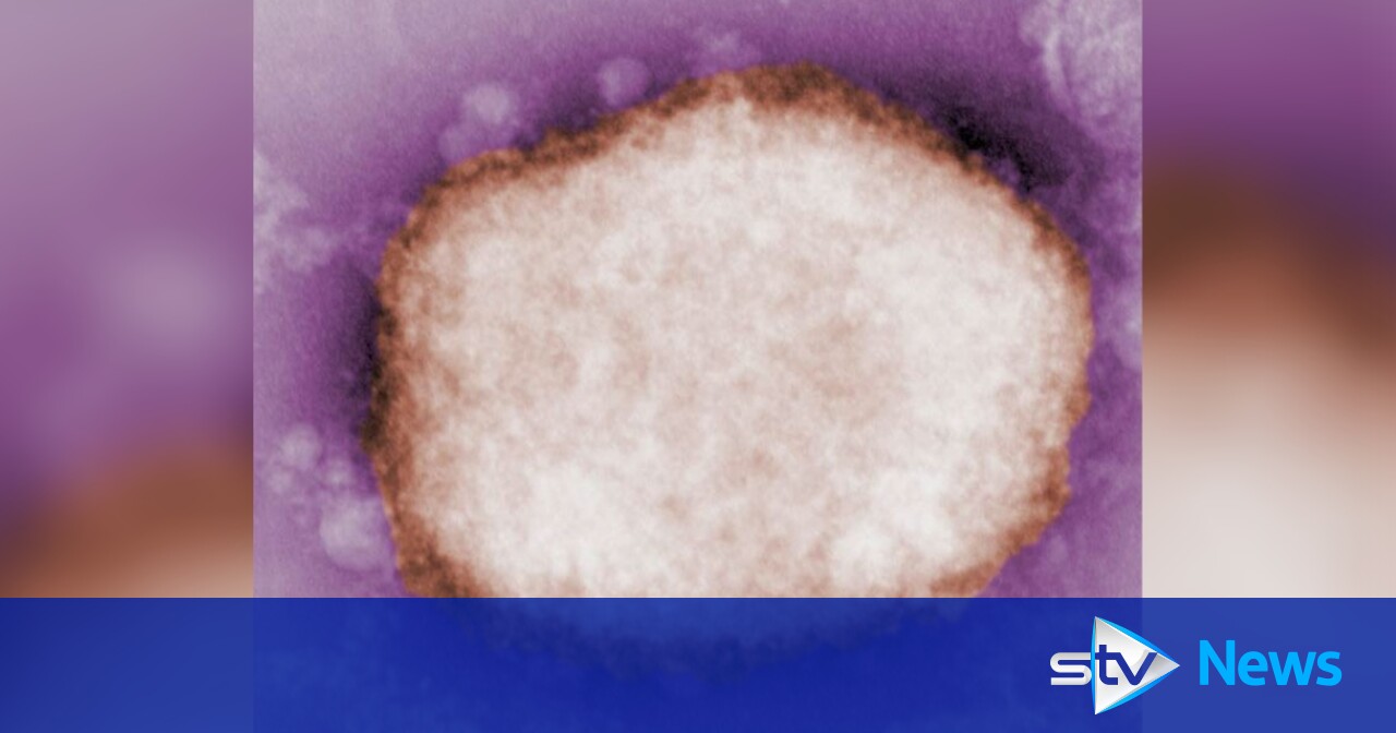 First monkeypox case confirmed in Scotland: How can you catch it and ...
