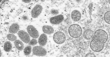 Further monkeypox case in Scotland as medics seek to eradicate disease