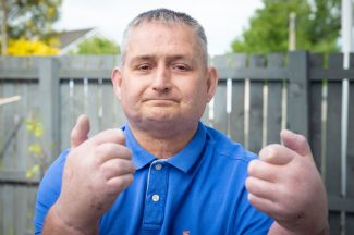 Steven Gallagher who underwent double hand transplant for scleroderma hopes to finally return to work