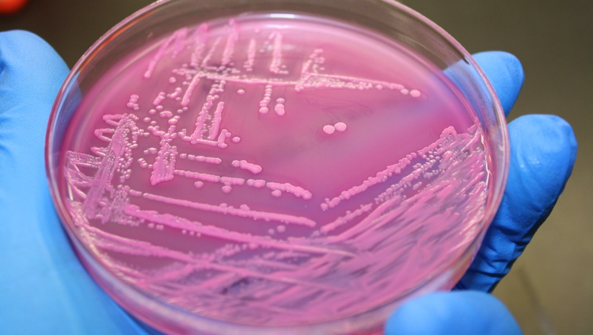 Nurseries closed in E.coli outbreak cleared to reopen