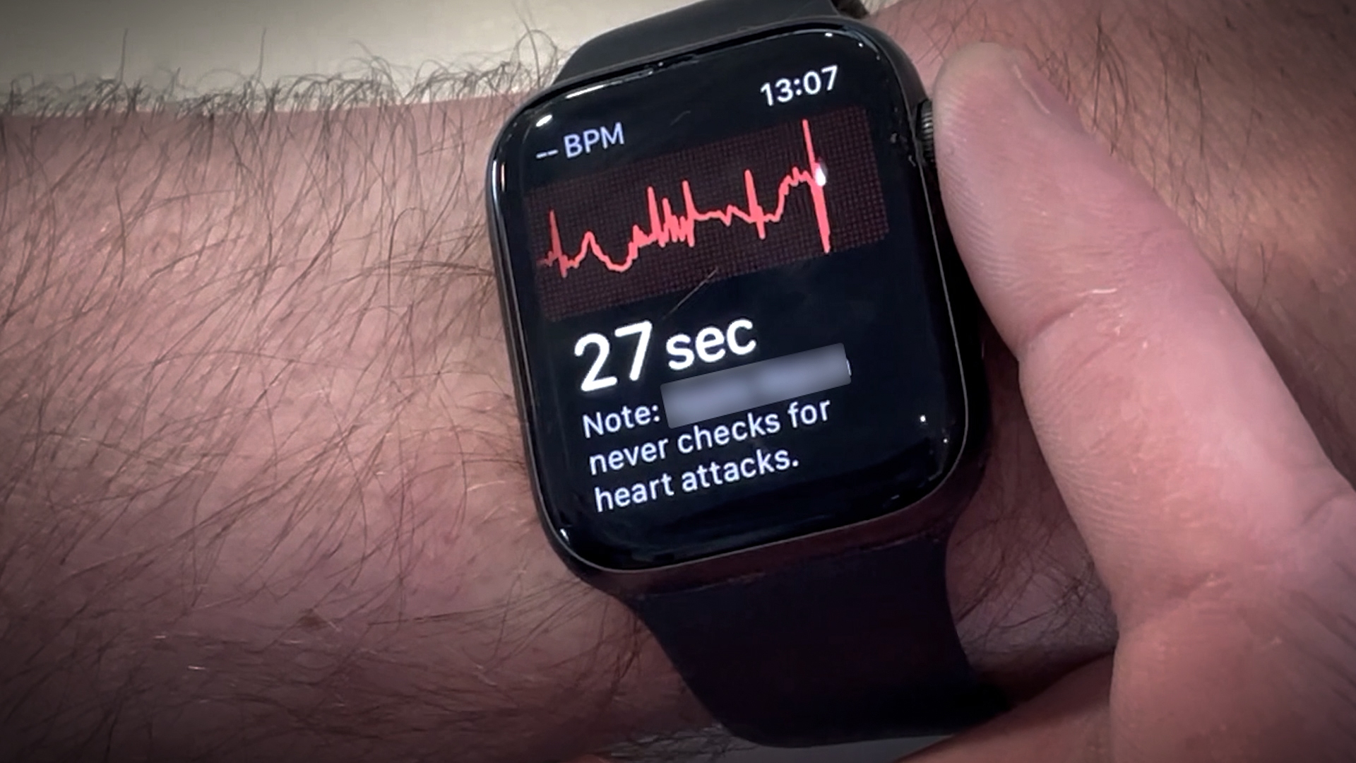Andrew's smartwatch showed a dangerously low heart rate.