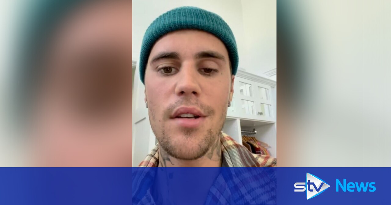 Justin Bieber says virus has left one side of his face paralysed 