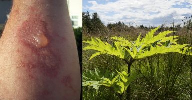 Scots warned of giant hogweed plant that can cause blisters, burns and blindness as school holidays start