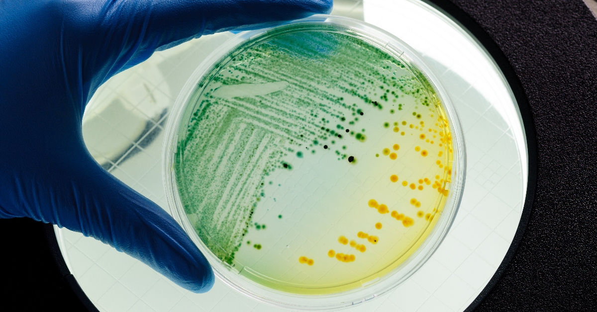 View of E. coli bacterium growing in petri dish seen through magnifying glass.