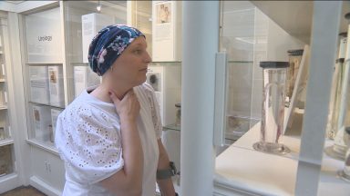 Mesh implant to go on display at medical museum