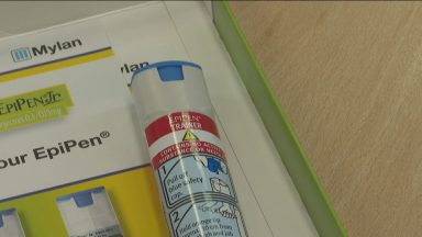 A trial hoping to make severe food allergies a thing of the past will be extended to Scotland