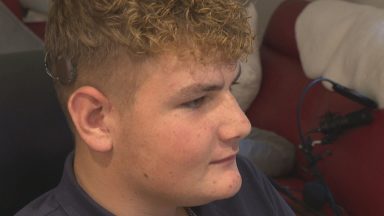 Dunblane teenager becomes first in Scotland to get revolutionary OSIA hearing implant