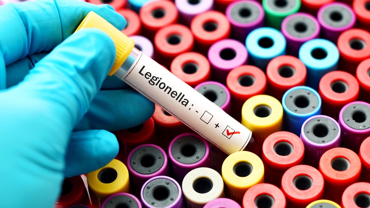 Concern of legionella risk to residents at Rutherglen sheltered housing after Legionnaires’ disease diagnosis
