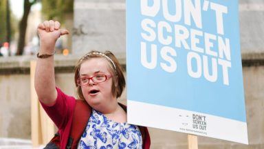 Woman loses Down’s Syndrome abortion case at Court of Appeal