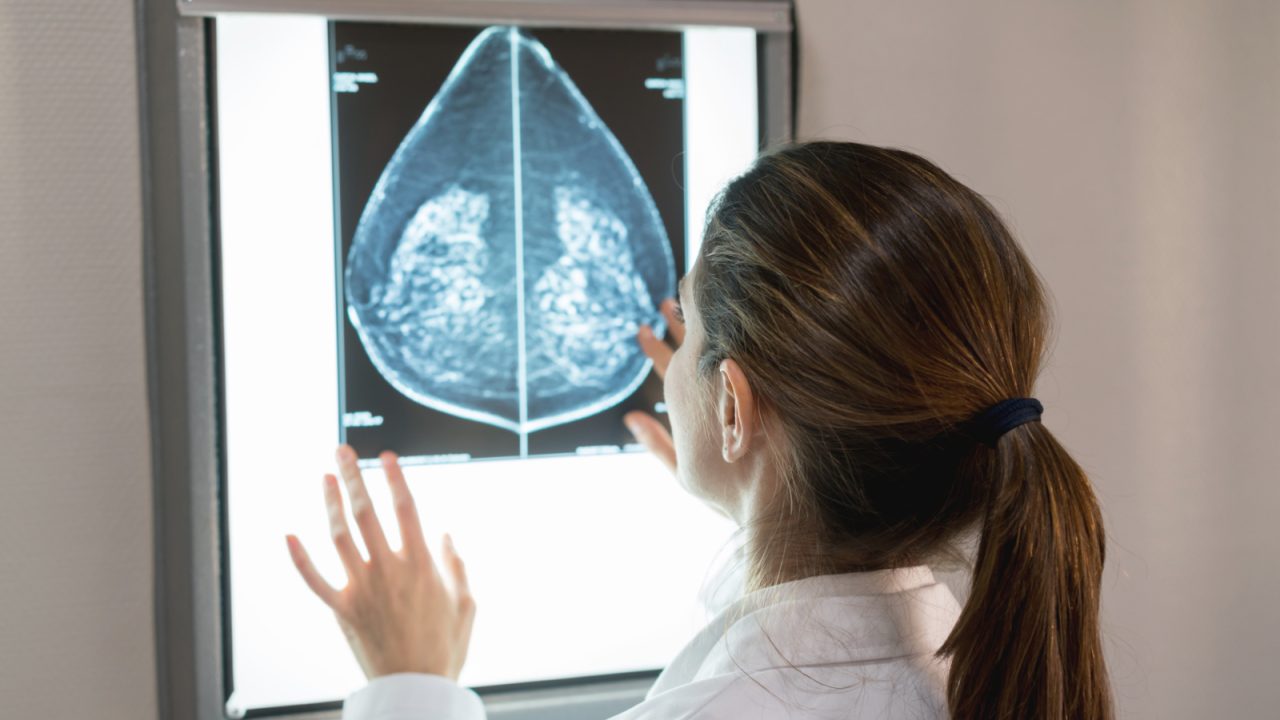Concerns raised about ‘shocking disparity’ in breast screening rates in Scotland