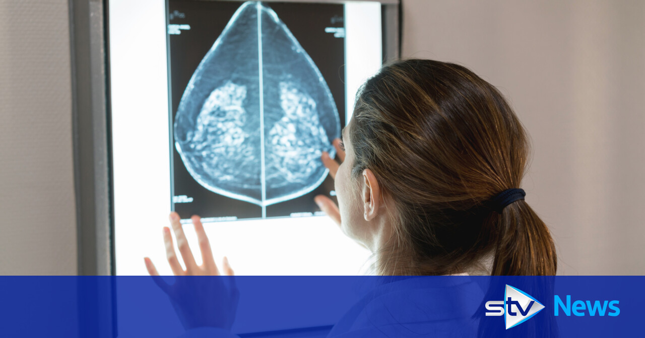 NHS England to offer 'potentially life-saving' drug for aggressive breast  cancer, Breast cancer