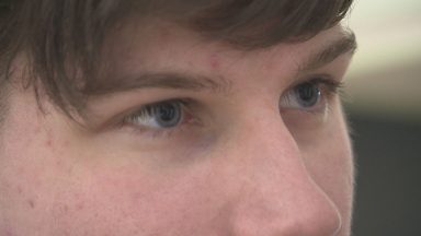 Aberdeenshire man has sight restored after treatment in Germany