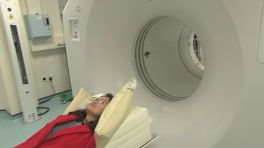 Radioactive particle to identify brain tumours is helping treat patients