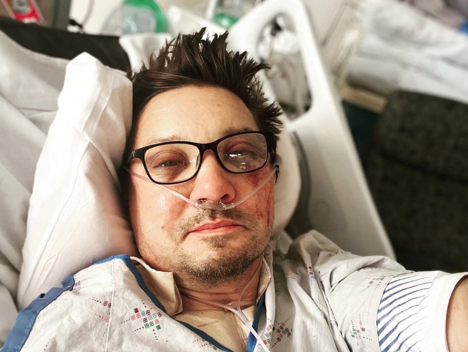 Renner sustained 30 broken bones in the incident. 