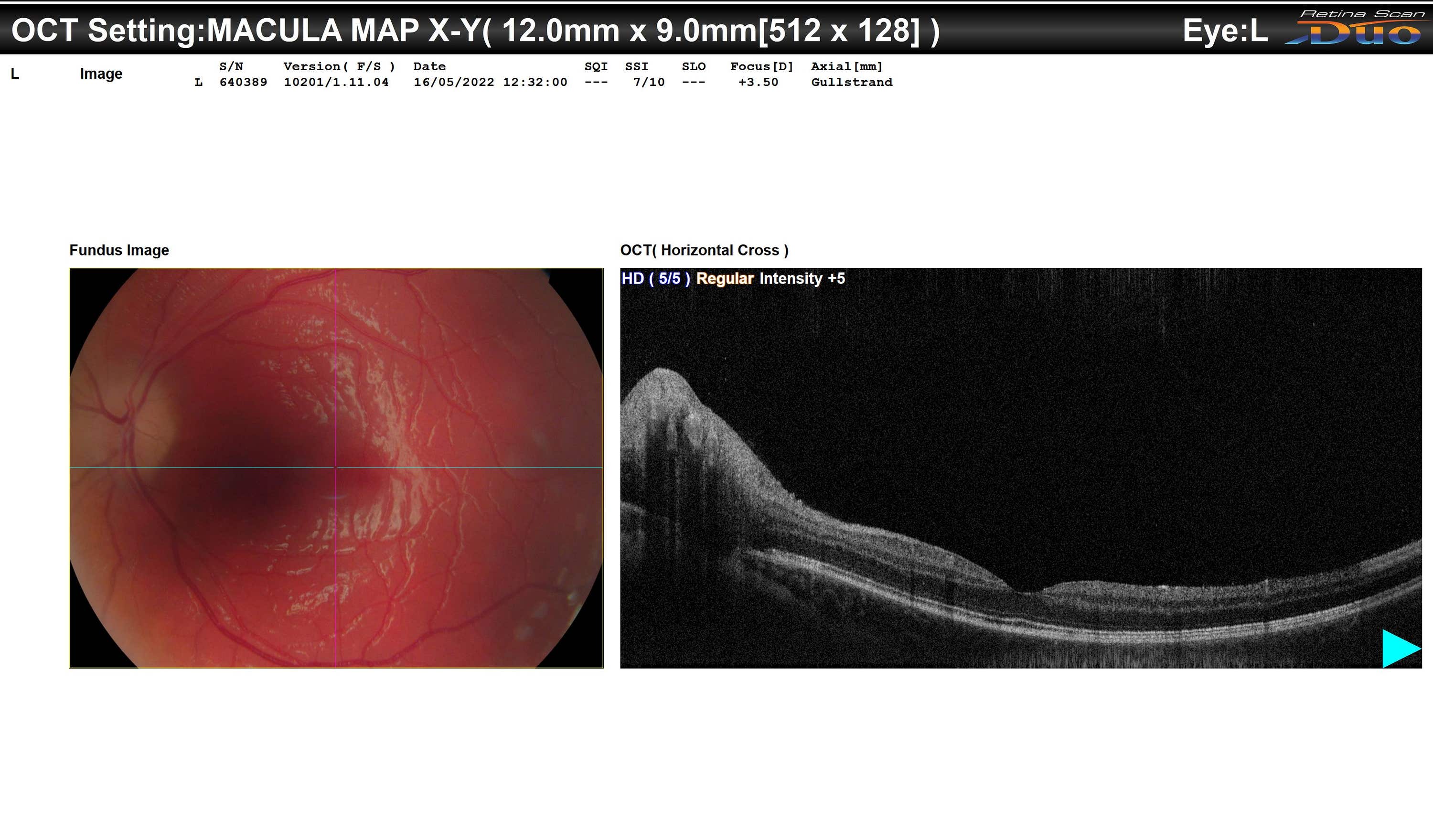 Carly’s scans of she had done at the hospital.