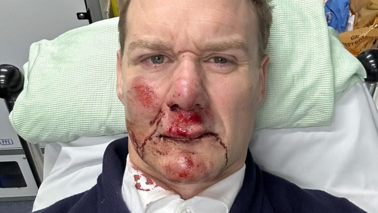 TV presenter Dan Walker ‘glad to be alive’ after he was knocked off bike by car