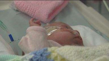 Premature babies get brain boost from breastmilk finds study