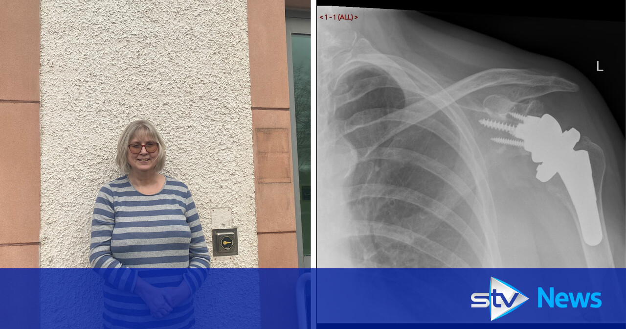 NHS Lanarkshire surgeons first to send patients home on same day