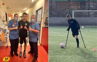 Teenage footballer from Glasgow keeps Scotland dream alive after losing leg to bone cancer