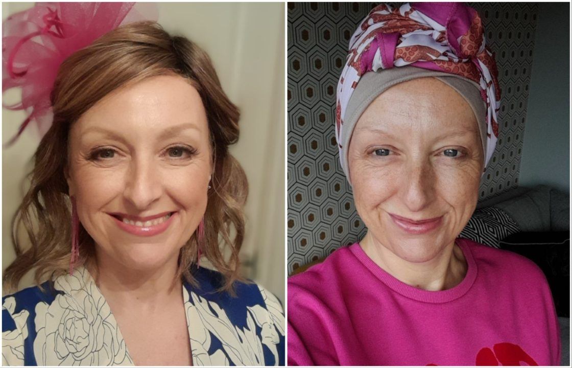 Woman uses life savings to fund ovarian cancer surgery due to NHS waiting times
