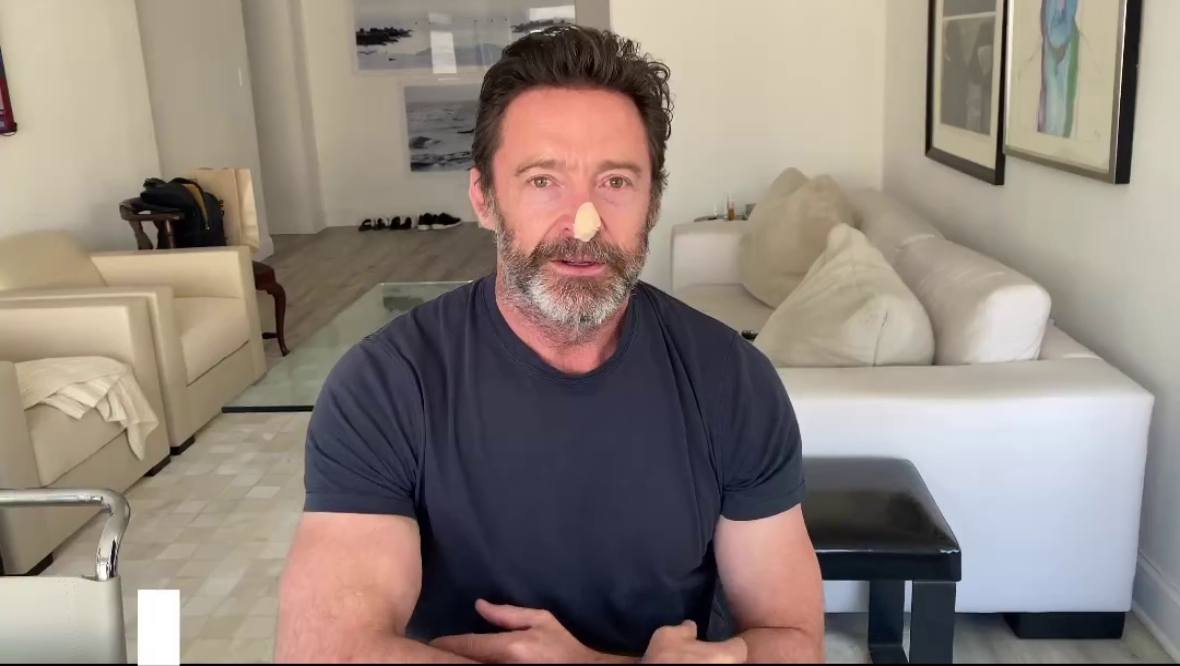 Australian actor Hugh Jackman urges people to practice sun safety amid latest basal-cell carcinoma scare