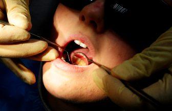 NHS Scotland dentistry capacity down 52% since before pandemic, research finds