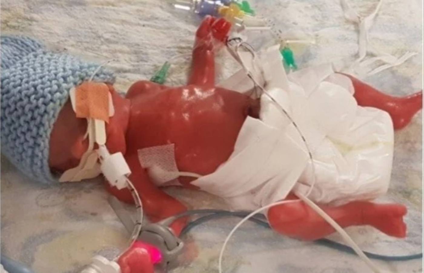 Innes was born at the neonatal unit in Wishaw in 2019.