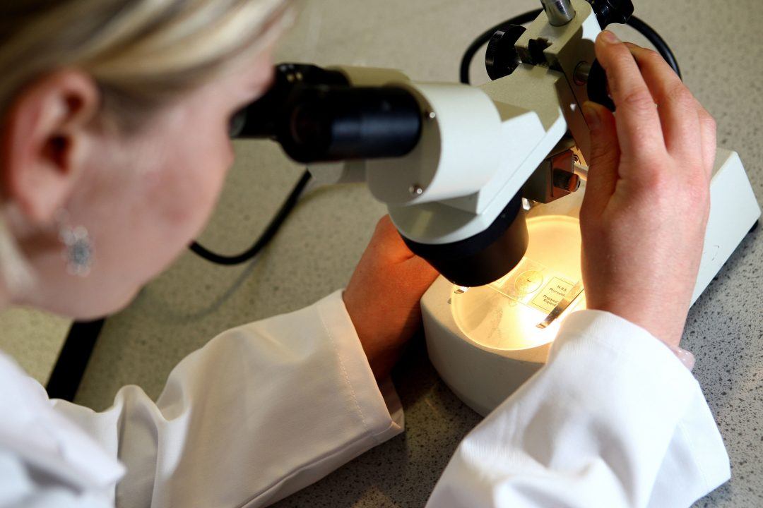 Glasgow University scientists target ‘first stop’ of prostate cancer spread