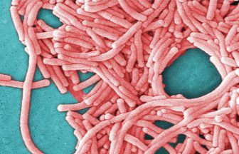 Legionella bacteria found inwater supply of cancer treatment radiotherapy ward Edinburgh Western General Hospital