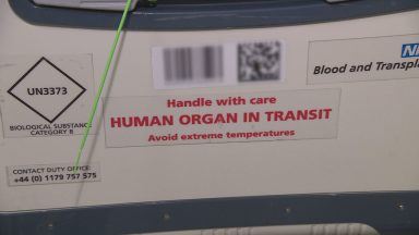 Scots urged to help save lives through organ donation views