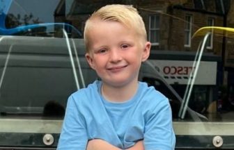 Boy, 7, bitten on leg and back in Edinburgh play park dog attack