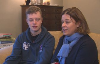 Fife teenager among first to undergo life-changing epilepsy surgery in Scotland