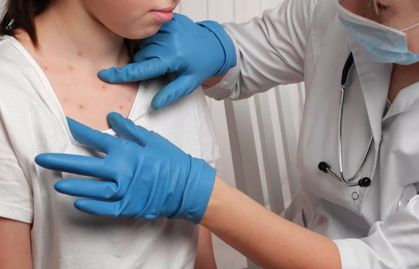 Measles: Rise in cases