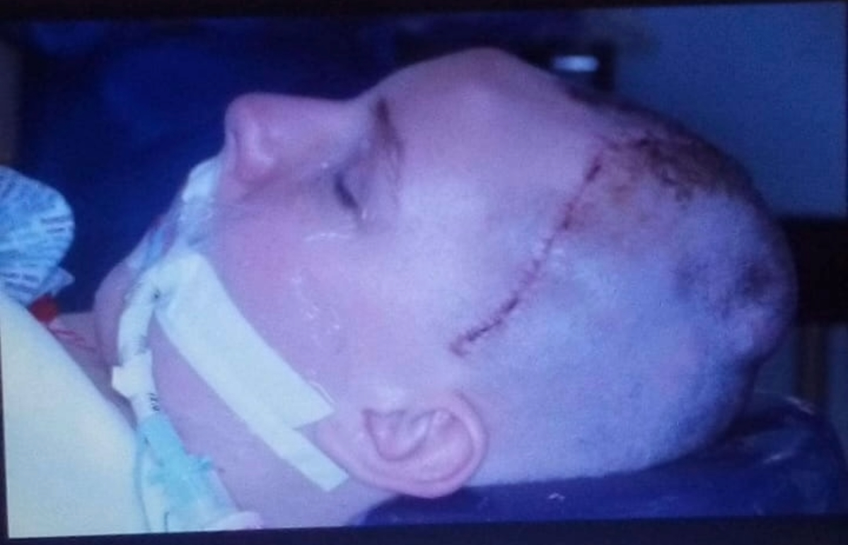 Barry Wallace 's skull was smashed into at least ten pieces after he was hit by a train.