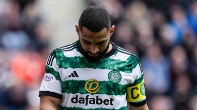 Cameron Carter-Vickers insists Celtic can take positives from Hearts defeat