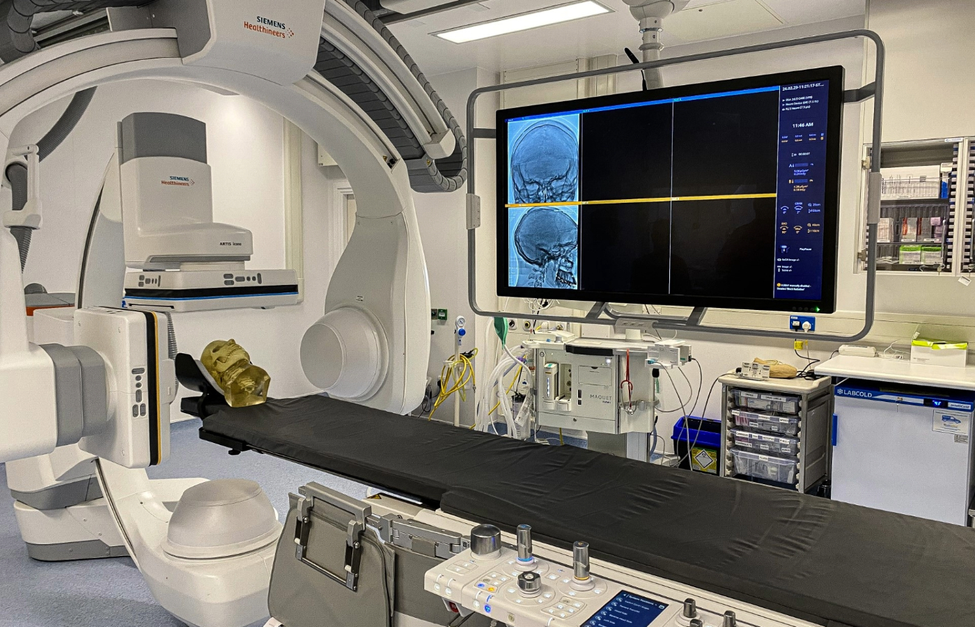 'Lifechanging' service launched in Glasgow hospital for stroke