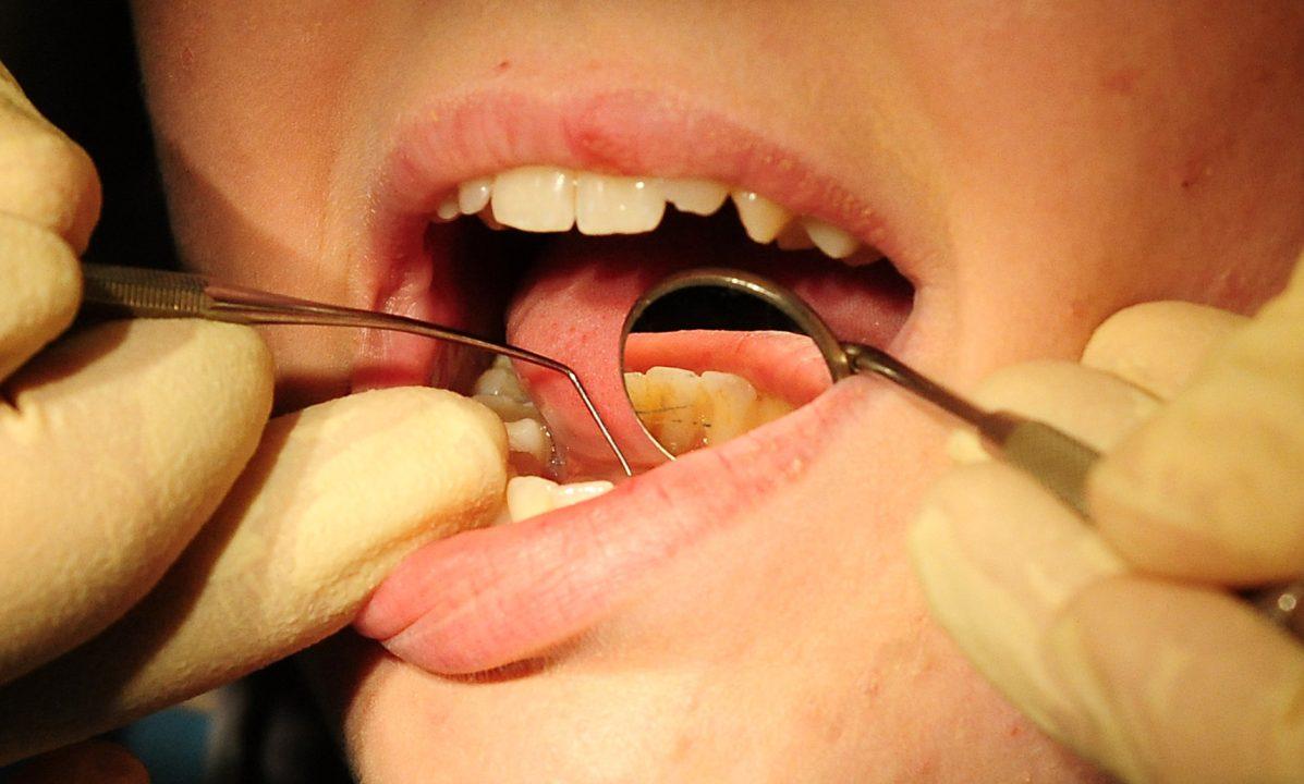 Dentist. Dental. Teeth. Labour leader Anas Sarwar has warned Scotland faces a ‘two-tier dentistry system’.